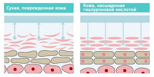 Πώς λειτουργεί το υαλουρονικό
