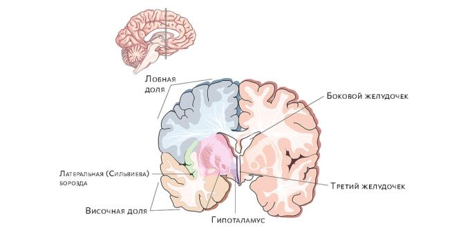 Κοιλίες εγκεφάλου. Η συσσώρευση υγρού σε αυτά οδηγεί σε υδροκέφαλο.