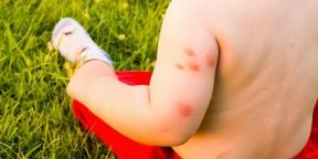 Τι να κάνετε εάν είστε αλλεργικοί στα τσιμπήματα κουνουπιών και σκνίπων