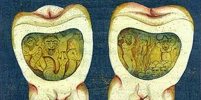 Μεσαιωνική Ιατρική: Μια σελίδα από την Οθωμανική οδοντιατρική πραγματεία, 17ος αιώνας.