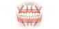 Πώς να αποκαταστήσει τα δόντια σας και το χαμόγελο πίσω